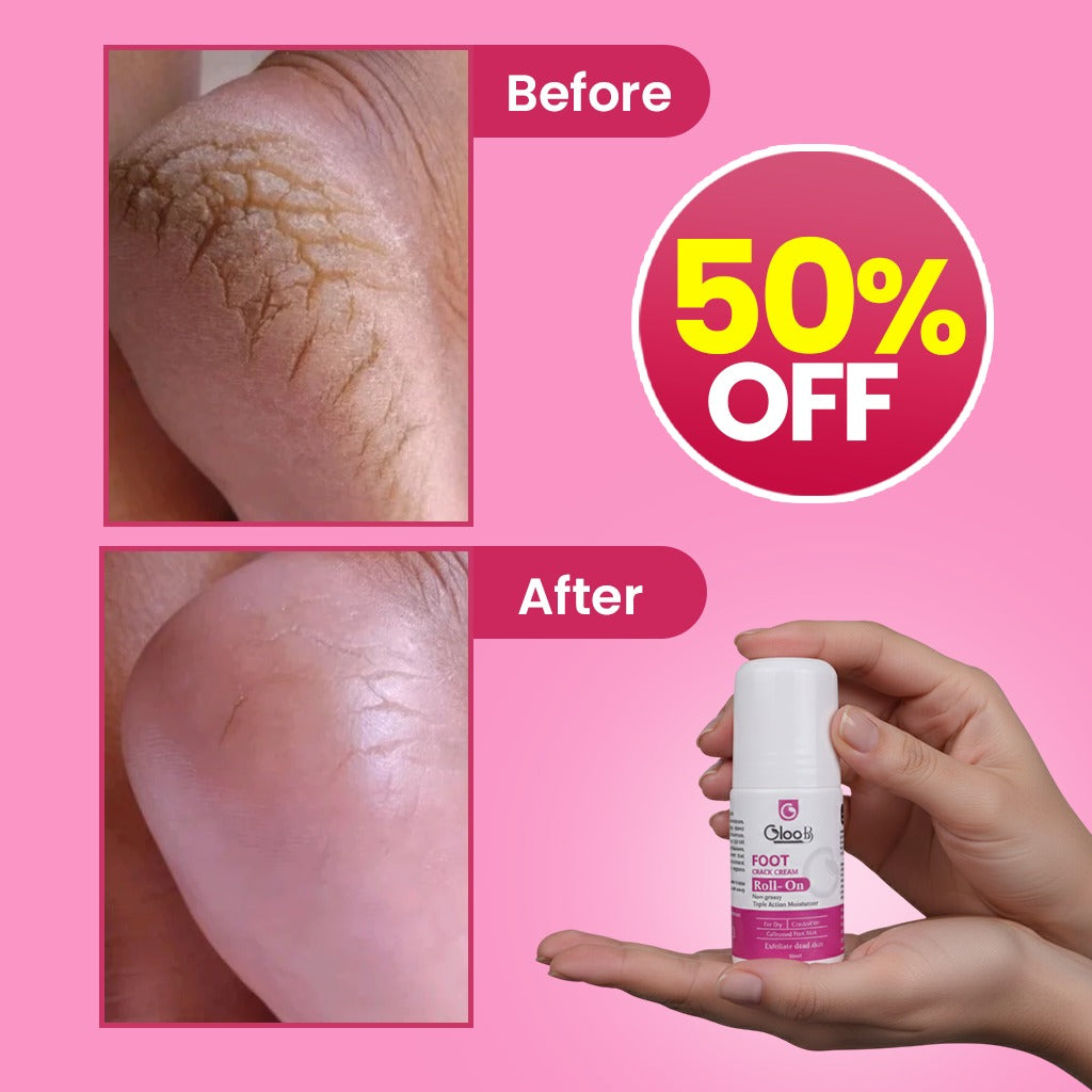 GlooB Foot Crack Cream Roll-On  Non-Greasy | Triple Action Moisturizer