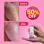 GlooB Foot Crack Cream Roll-On  Non-Greasy | Triple Action Moisturizer